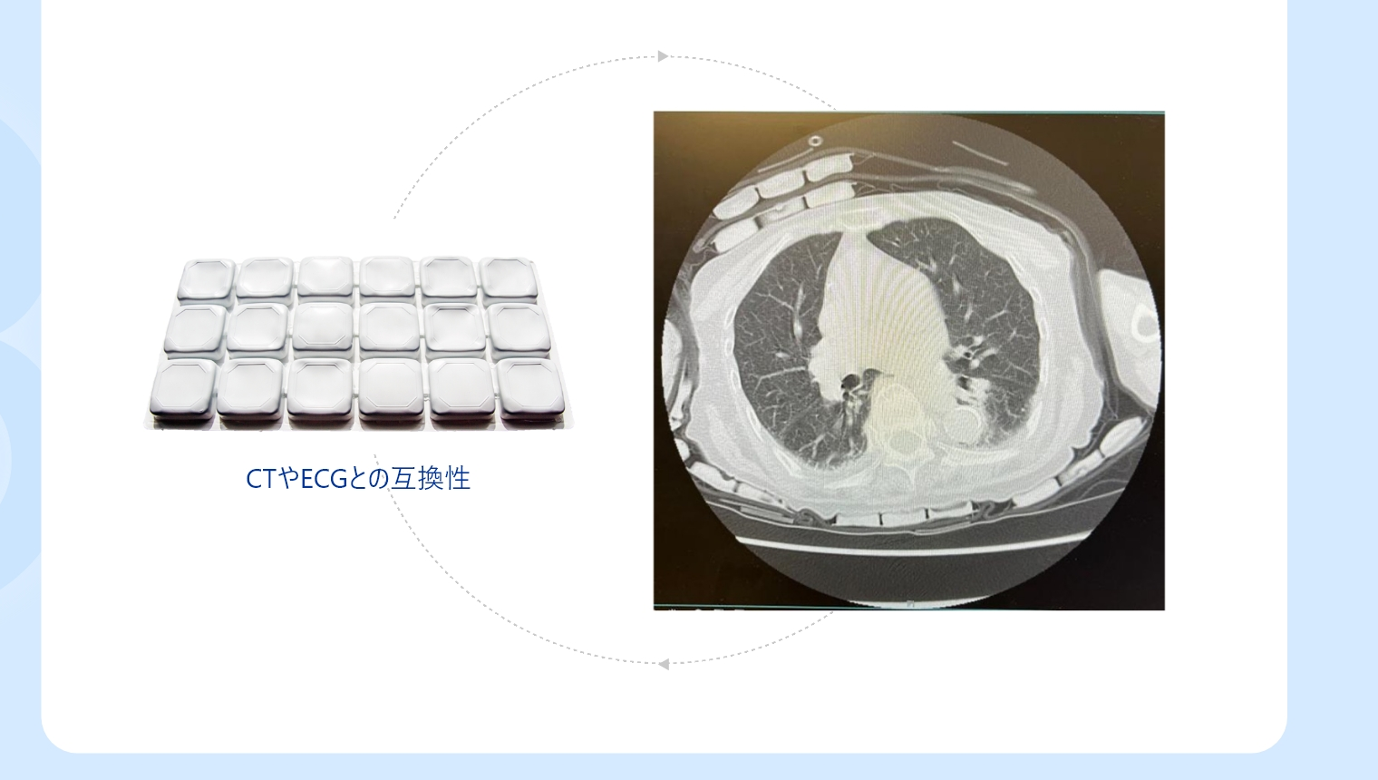 CTやECGとの互換性